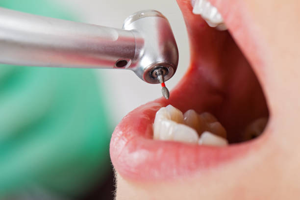 Best Same-Day Emergency Dentist in Isla Vista, CA